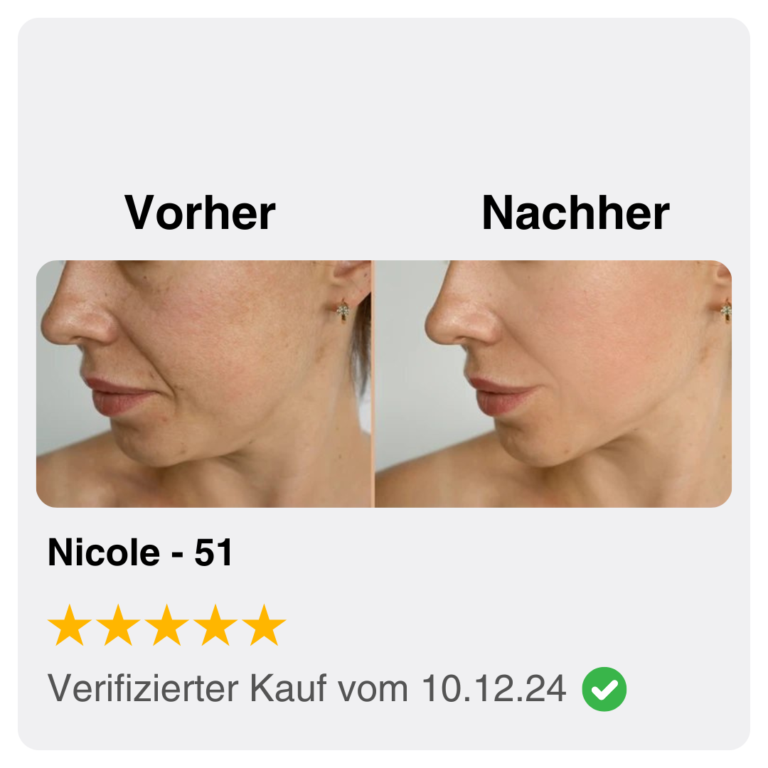 Youthful Glow Set® – Die Revolution für garantiert straffe, glatte und strahlende Haut in nur 2 Wochen