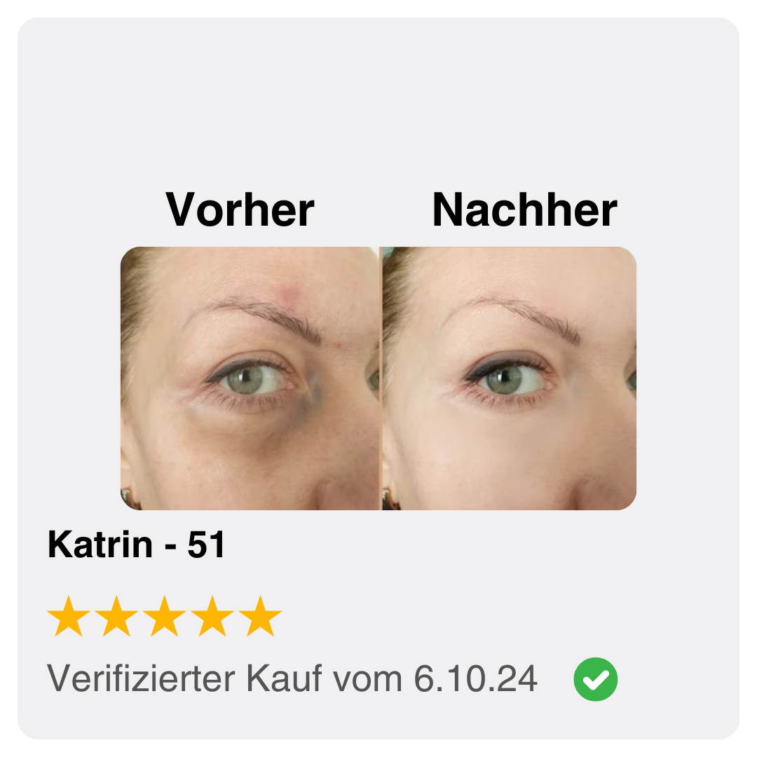 Youthful Glow Set® – Die Revolution für garantiert straffe, glatte und strahlende Haut in nur 2 Wochen